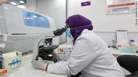 عایشه عبدی محمد ، یک تکنسین آزمایشگاهی ، از میکروسکوپ داخل آزمایشگاه Medipark Diagnostics که آزمایشات بیماری ویروس کرونا (COVID-19) را در موگادیشو ، سومالی در 14 اکتبر 2020 انجام می دهد ، استفاده می کند.
