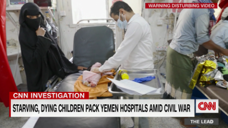 A CNN investigation finds the U.S.-backed Saudi blockade is leading to deadly fuel &amp; food shortages in Yemen, where hospitals are full of starving children