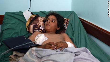 Saif Abalwi, 13, was admitted to Marib General Hospital after being injured in a Houthi missile attack. 
