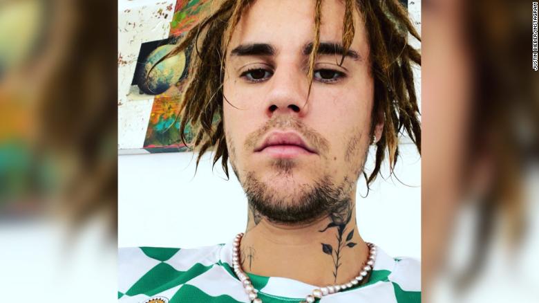 Justin Bieber is being accused of cultural appropriation over his hair. Ancora.