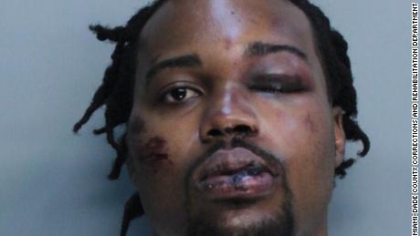 Francois Alexandre&#39;s injuries are seen in a mugshot taken after he was arrested. Charges against him were later dropped.