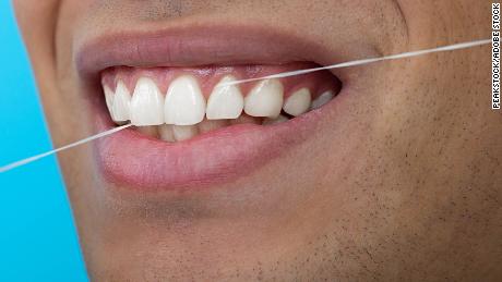 A pesquisa mostra que o uso do fio dental pode proteger contra o declínio cognitivo