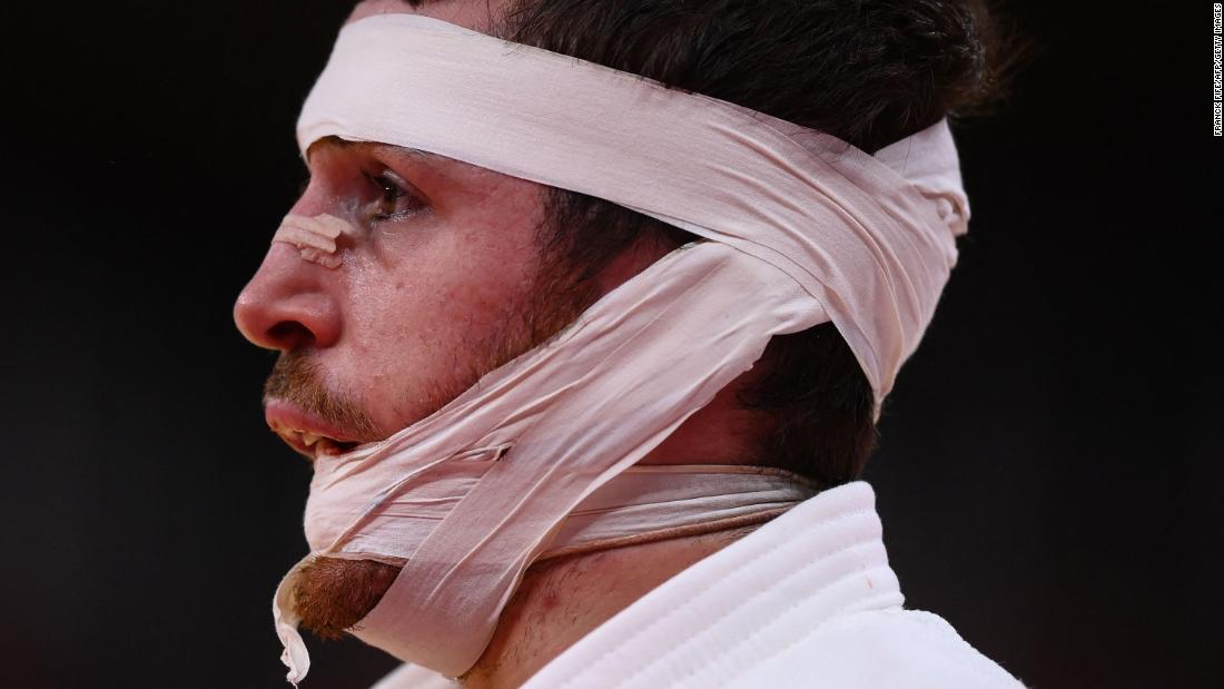Spanish judoka Alberto Gaitero Martin is bandaged during his bout against Ukraine&#39;s Georgii Zantaraia on July 25.