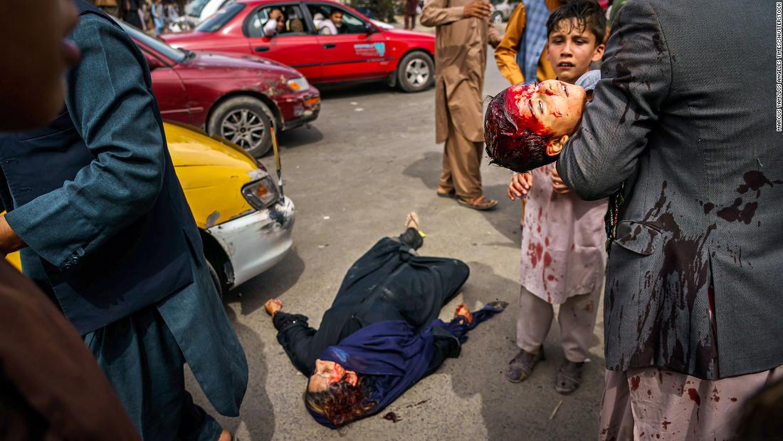 A man carries a bloodied child as a wounded woman lies on the street after Taliban fighters fired guns and lashed out with whips and other objects to control a crowd outside the airport in Kabul on August 17. &quot;The violence was indiscriminate,&quot; &lt;a href =&quot;https://twitter.com/AC360/status/1427797623105327115&quot; 目标=&quot;_空白&quot;&gt;Los Angeles Times photographer Marcus Yam told CNN.&amltlt;/一个gtmp;gt; &quot;I even watched one Taliban fighter, after firing some shots in the general direction of the crowd, smiling at another Taliban fighter — as though it were a game to them or somethin报价mp;quot;