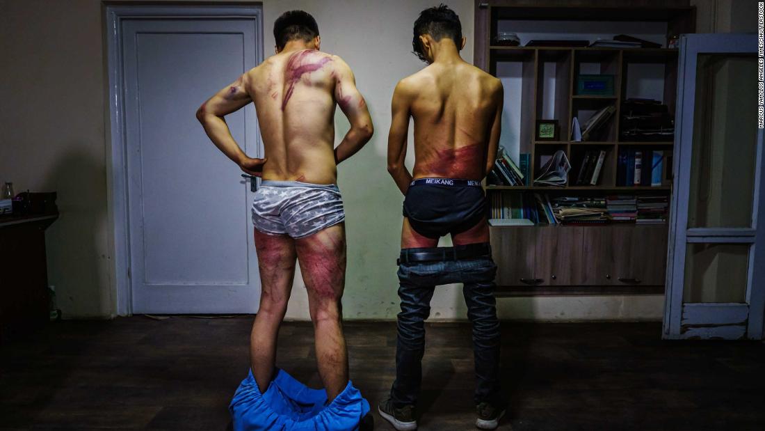 Journalists from the Etilaatroz newspaper — video journalist Nemat Naqdi, 剩下, and video editor Taqi Daryabi — undress to show wounds they sustained after Taliban fighters tortured and beat them while in custody. They had been arrested while reporting on a women&#39;s rights protest in Kabul on September 8.