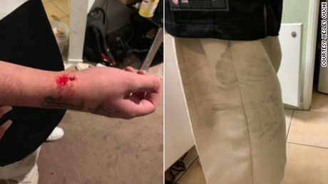 Photos of Anthony Romero&#39;s injury as well as of the alleged shoeprints that were provided by his attorney.