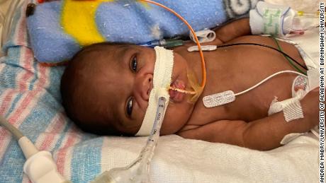 An Alabama baby was born less than 1 pound and at 21 settimane. Ora detiene un record mondiale