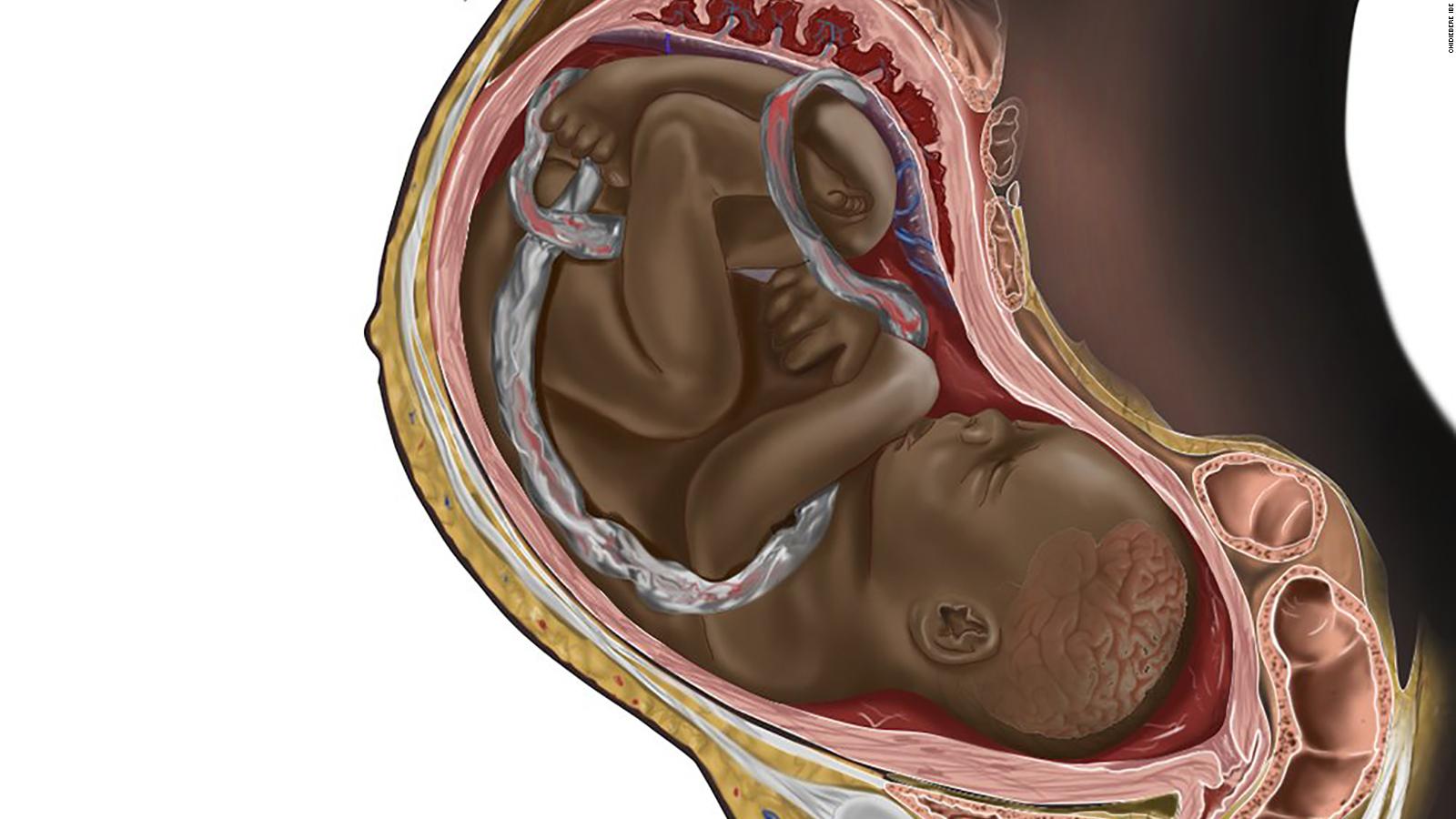 A Viral Image Of A Black Fetus Is Highlighting The Need For Diversity