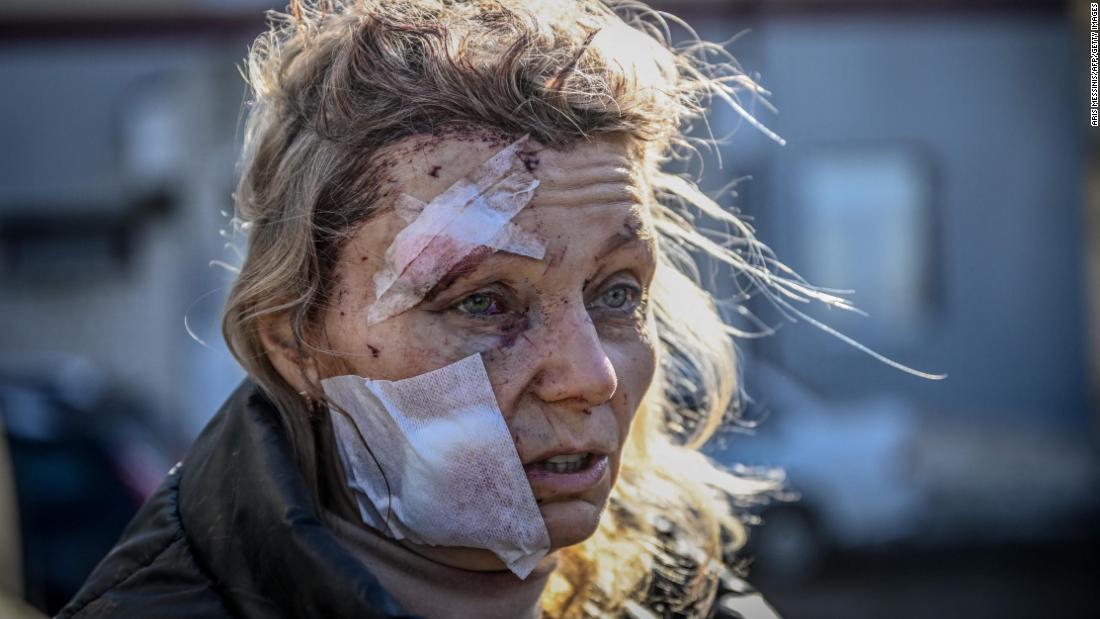 A wounded woman stands outside a hospital after an attack on the eastern Ukrainian town of Chuhuiv, outside of Kharkiv, on February 24.