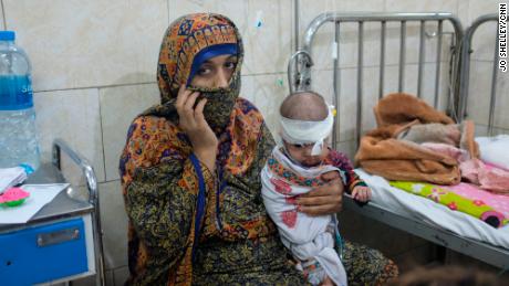 Shazia&#39;s seven-month-old baby Angela has severe pneumonia and malnutrition.
