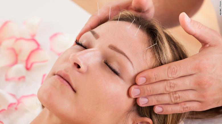 Una práctica antigua puede reducir los dolores de cabeza crónicos por tensión, estudio dice