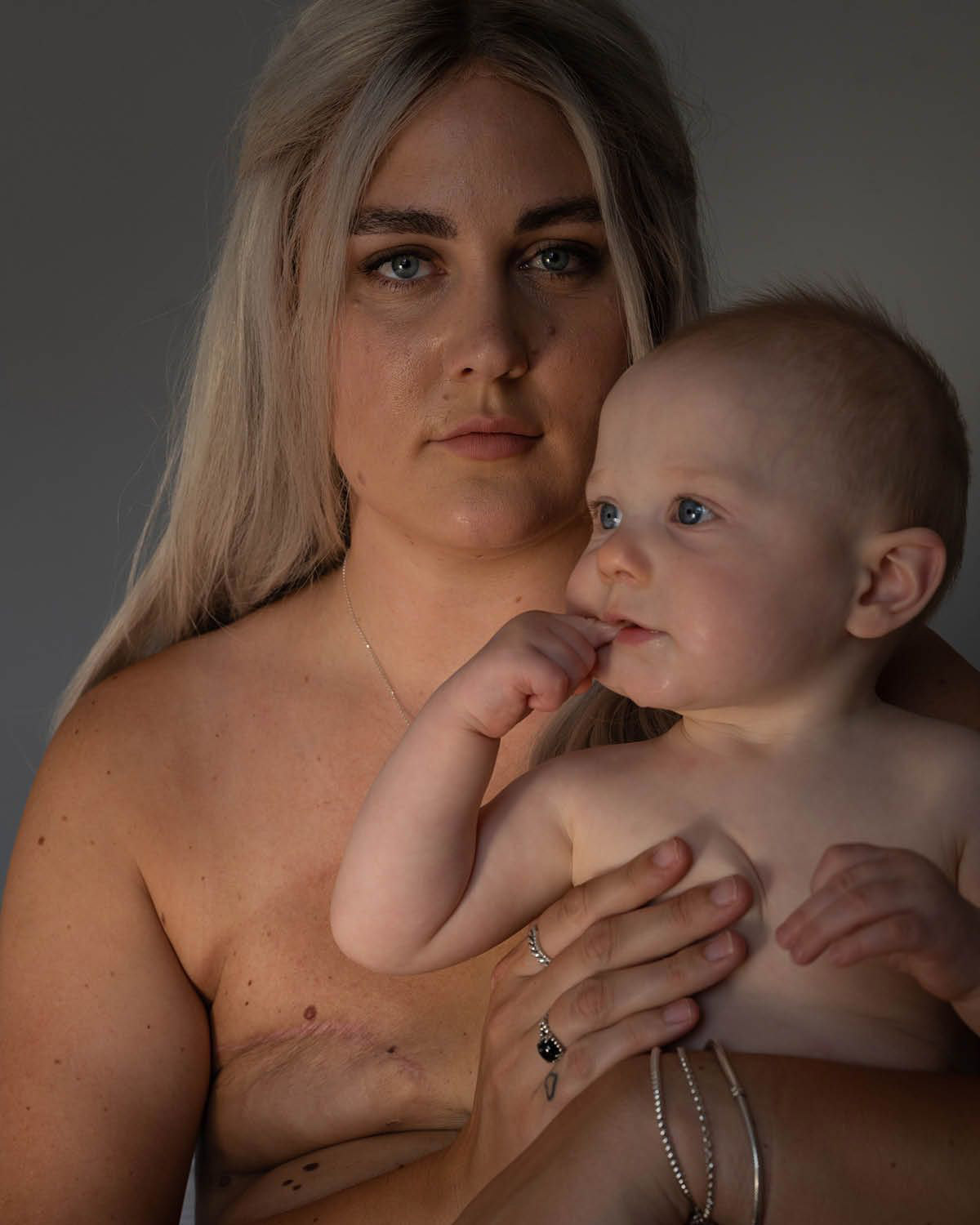 They survived breast cancer. Now they're baring their scars — and their  souls 