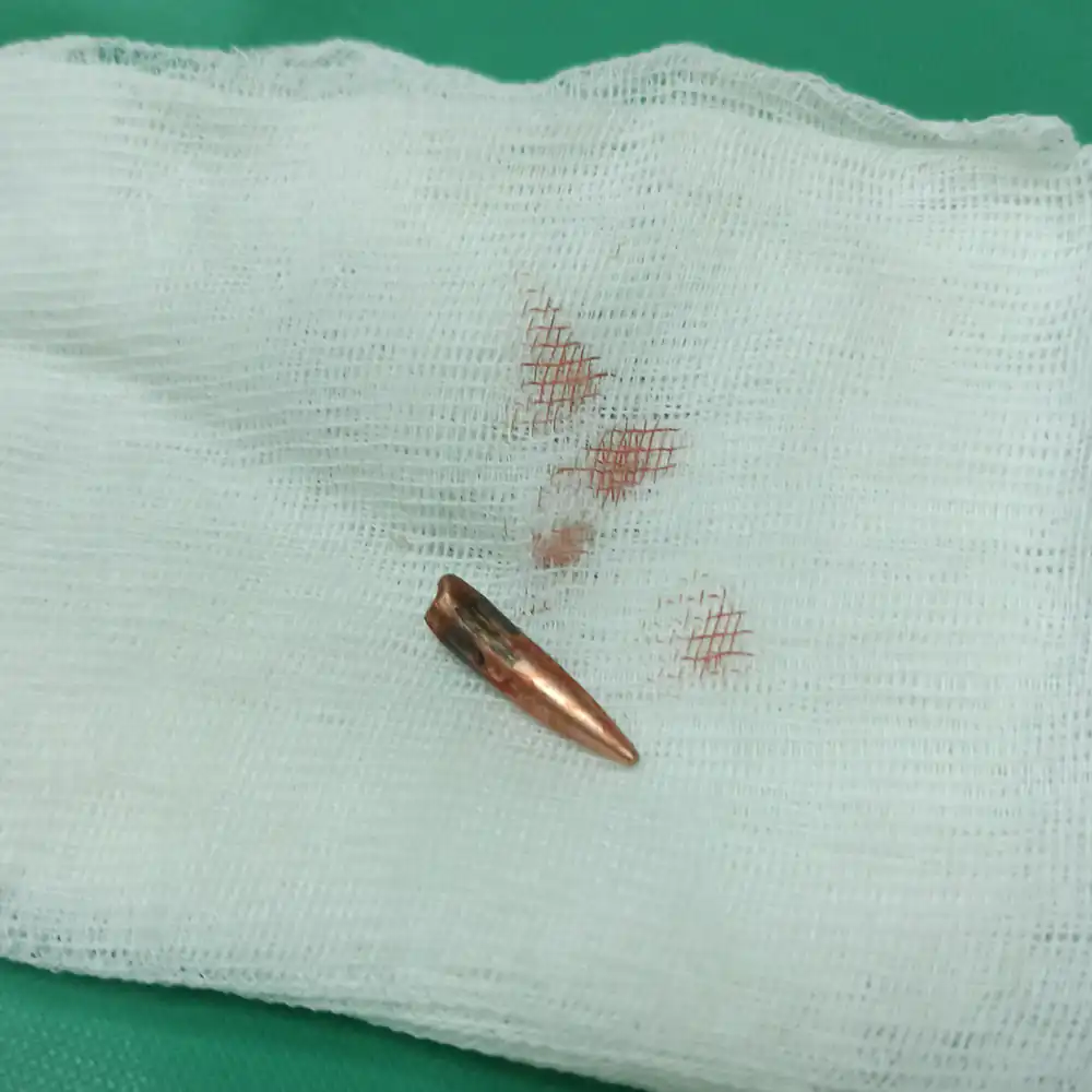 A metal bullet on white medical gauze dotted with blood stains.
