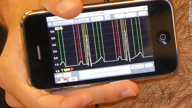 smartphone cardiograph