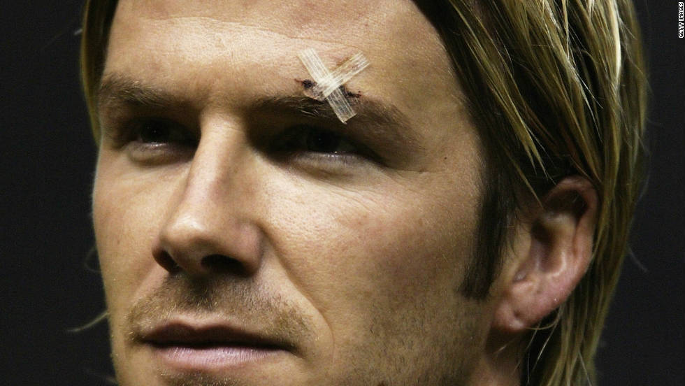 In 2003, he infamously kicked a boot into the face of Beckham in the dressing room after a match, but refused to apologize. &quot;If I&#39;d tried it 100 times or million times, it wouldn&#39;t happen again,&quot; he said. &quot;If it did, I would carry on playing.&quot;