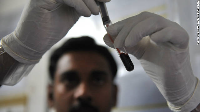 Fewer young adults getting HIV tests, here's why