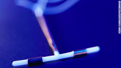 Study: IUDs, implants vastly more effective than the pill