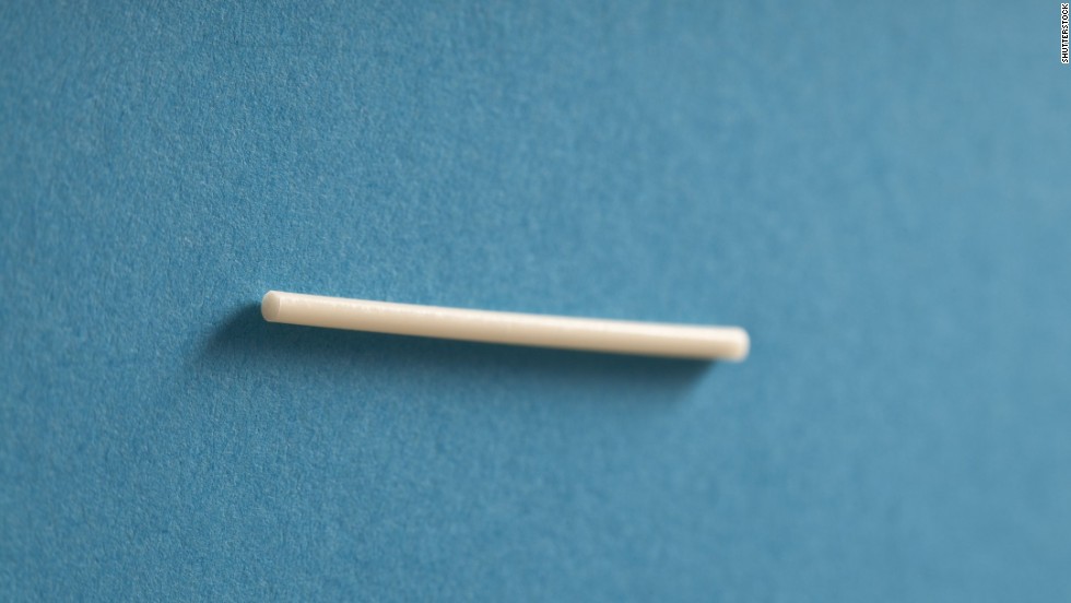Implants are flexible matchstick-size devices that are surgically inserted into a woman&#39;s arm. They slowly release the hormone progestin into the body, preventing a woman&#39;s ovaries from releasing eggs. The protection can last several years. 