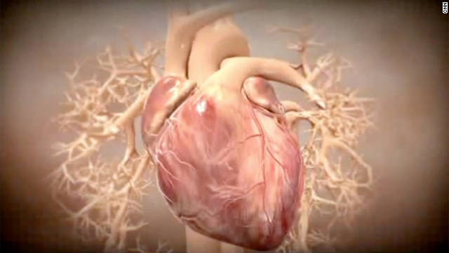 A new study says heart damage may be reversible with stem cell therapy without dangerous side effects.