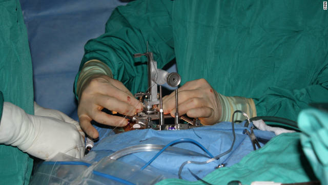 Dr. Nicholas Boulis adjusts the device that injects stem cells into the cervical area of the spinal cord.