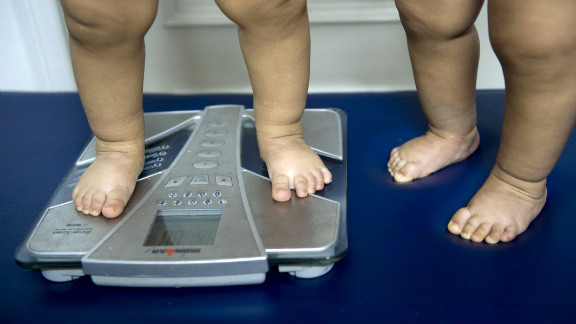 Obesity Causes Early Puberty Opinion
