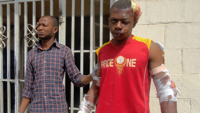 A paramedic helps a man who was injured during one of the attacks in the Nigerian city of Kano 