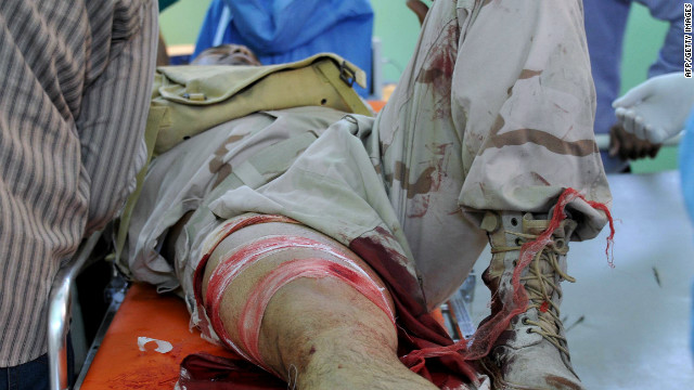 An injured soldier from the ruling National Transitional Council lies on a stretcher on March 30 at a hospital in Sabha.