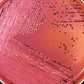 Salmonella bacteria petri dish