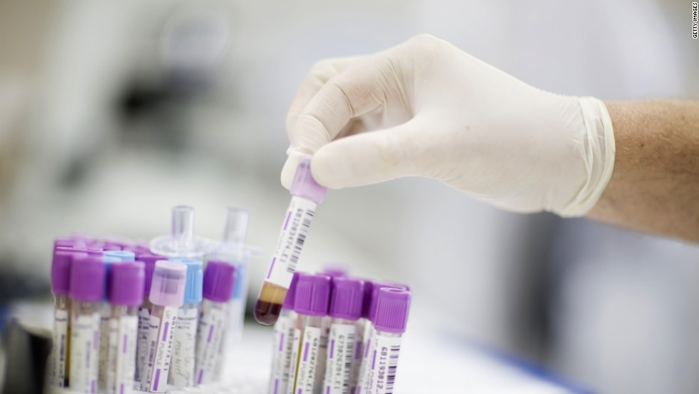 new-blood-test-to-revolutionize-advanced-prostate-cancer-therapy