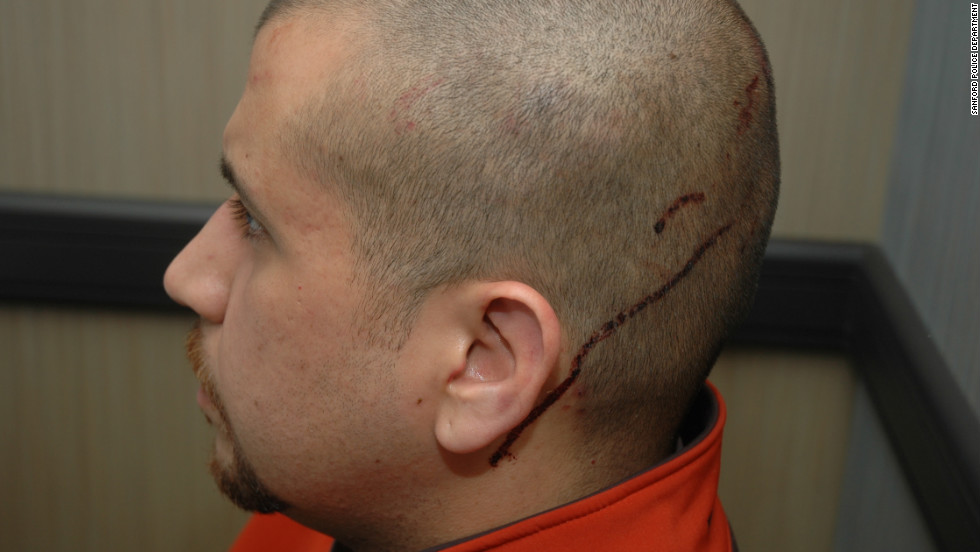 Zimmerman said that before he shot the teenager, he was &quot;assaulted (by Martin) and his head was struck on the pavement,&quot; according to a police report.