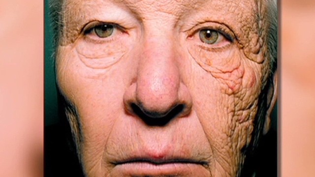 Trucker says sun did THIS to his face
