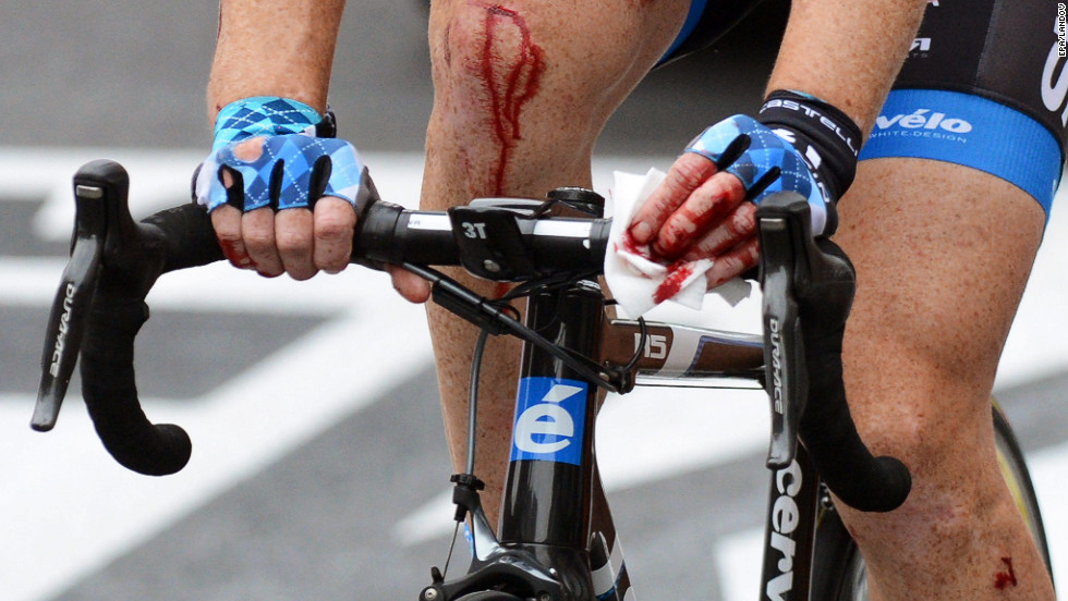 Farrar bleeds from multiple wounds as he rolls through to the finish line after crashing in the final sprint Thursday.