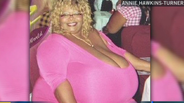 Annie Hawkins-Turner has the largest natural breasts in the world. 