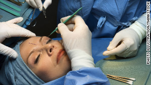 The most popular plastic surgery procedure is ...