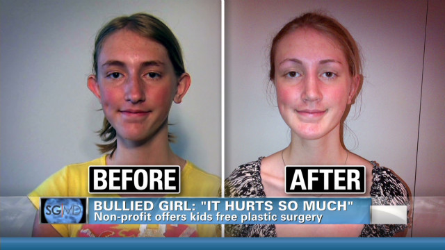 free free plastic surgery