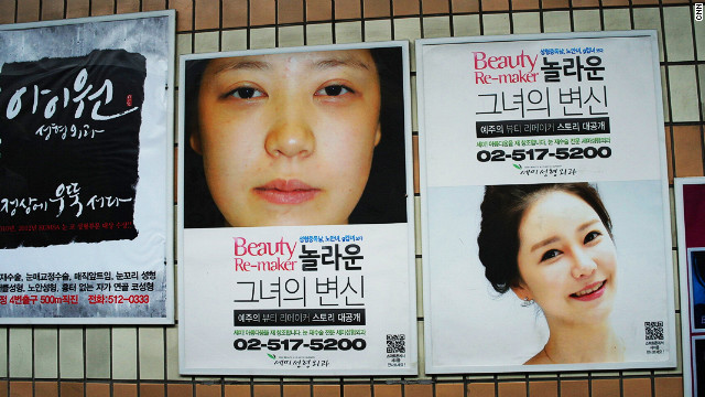 asian women plastic surgery