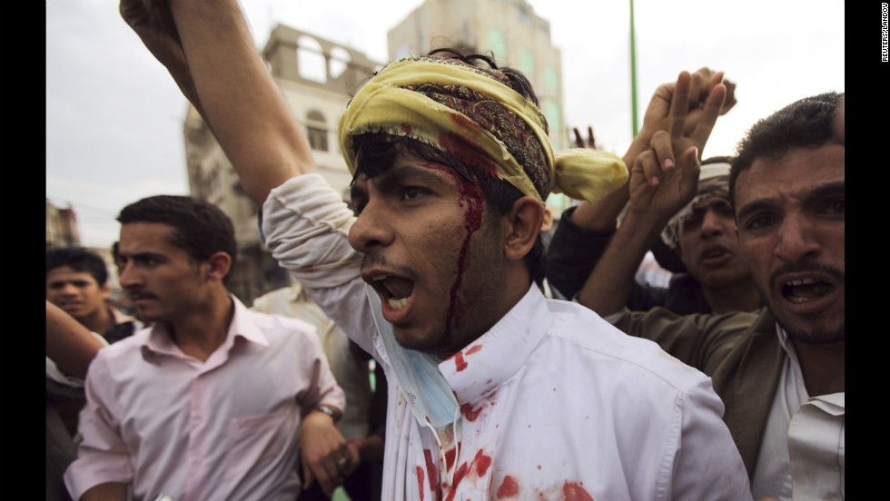 A protester shouts after sustaining injuries in a confrontation with riot police who fired tear gas outside the U.S. Embassy in Sanaa on Thursday.