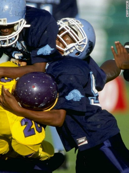 Limiting contact in practice may be one of the best ways to reduce head injuries in youth football, study finds
