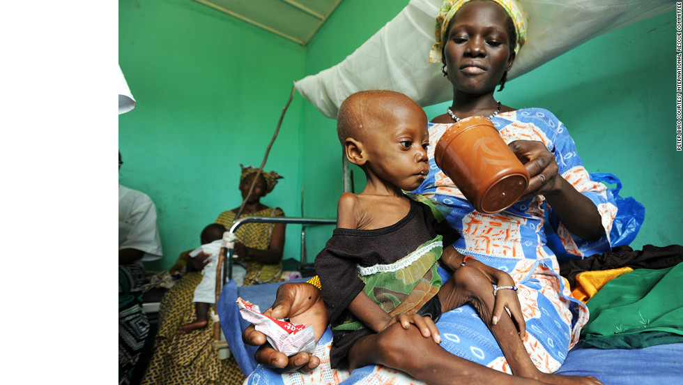 Only 16-months old, Jabadjie arrived at the health center in Kati weighing a little more than 9 pounds and suffering from pneumonia and anemia. Her normal weight should be twice that.  