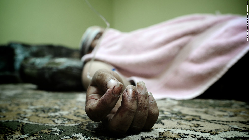 A Bahraini Shiite man lies in his house after being wounded in the clashes.