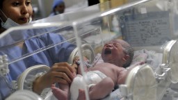 C-section deliveries nearly doubled worldwide since 2000, study finds