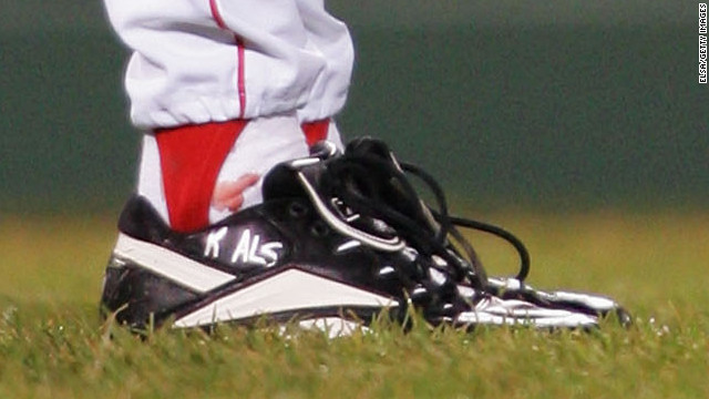 Curt Shilling&#39;s ankle injury bleeds through his sock before game 2 of the 2004 World Series on October 24, 2004.