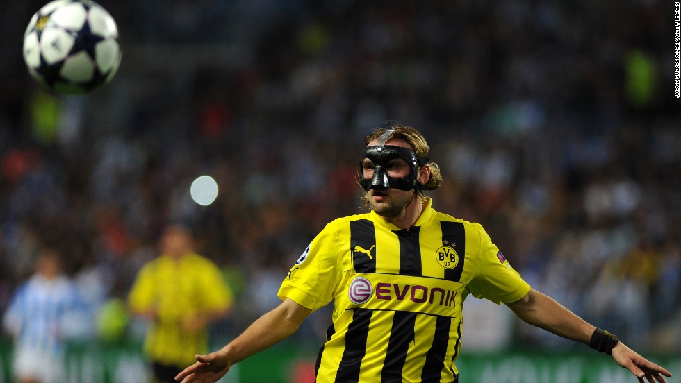 Marcel Schmelzer started in defense for Dortmund despite being forced to wear a mask after breaking his nose at the weekend.