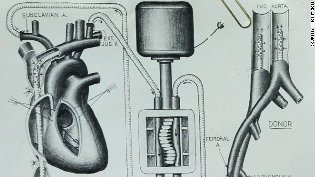 Vincent Gott&#39;s knack for illustrating heart procedures got him noticed by a preeminent heart surgeons.  