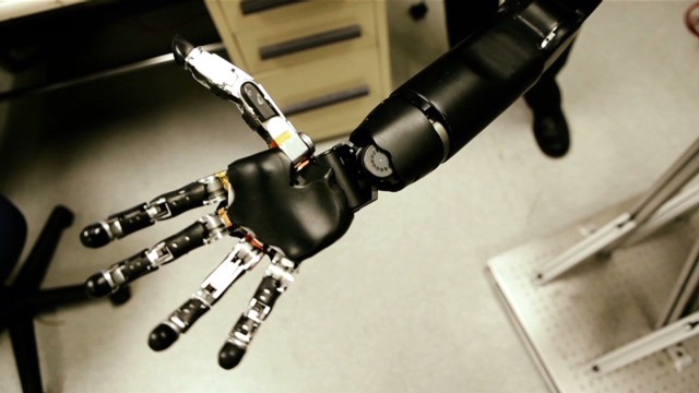 bionic hand