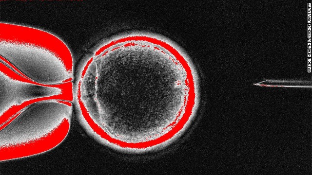 Cloning Stem Cells: What Does It Mean? - CNN