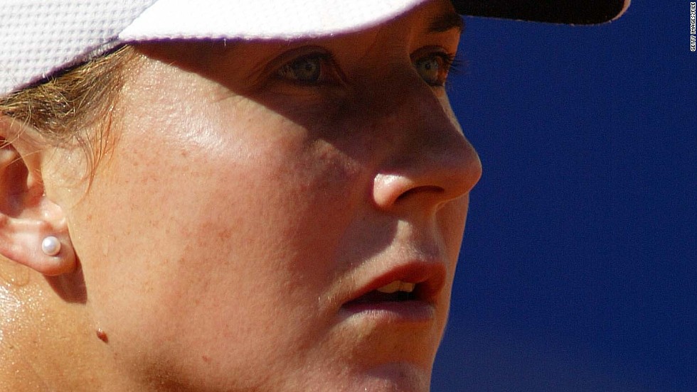 A foot injury forced Seles out of what would prove to be the final Tour match of her career at the 2003 Italian Open.