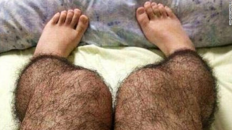Videos Of Girls With Hairy Legs