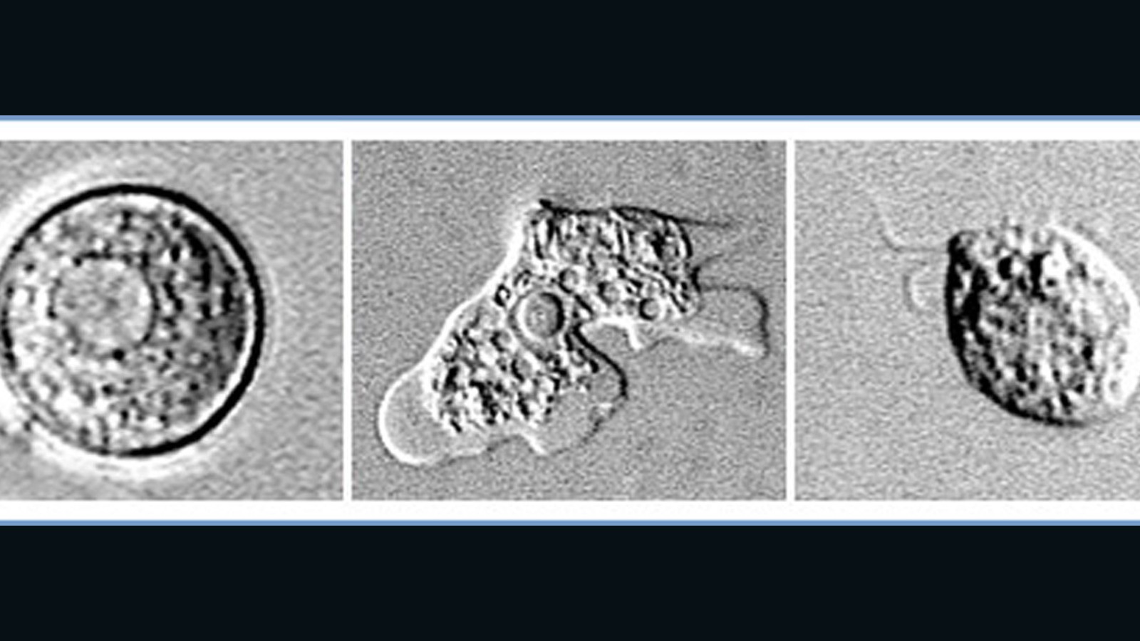 giant microbes brain eating amoeba