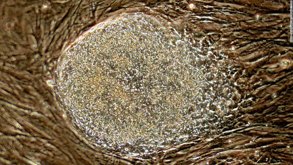 In August 2001, President George W. Bush announced that he would allow federal funding for about 60 existing stem cell lines created before this date. Above, a human stem cell colony, which is no more than 1 millimeter wide and comprises thousands of individual stem cells, grows on mouse embryonic fibroblast in a research laboratory in September 2001.